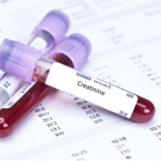 Creatinine Test From RB Diagnostic Creatinine Test From RB Diagnostic