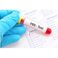 Glucose Fasting blood Test By RB Diagnostic Glucose Fasting blood Test By RB Diagnostic
