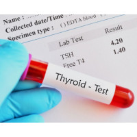 Thyroid Stimulating Hormone (TSH) Test By RB Diagnostic Thyroid Stimulating Hormone (TSH) Test By RB Diagnostic
