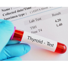 Thyroid Stimulating Hormone (TSH) Test By RB Diagnostic Thyroid Stimulating Hormone (TSH) Test By RB Diagnostic