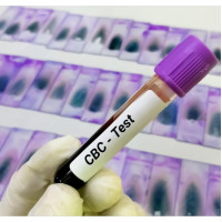 Complete Blood Count (CBC) Test By RB Diagnostic Complete Blood Count (CBC) Test By RB Diagnostic