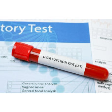 Liver Function Tests (LFTs) By RB Diagnostic Liver Function Tests (LFTs) By RB Diagnostic