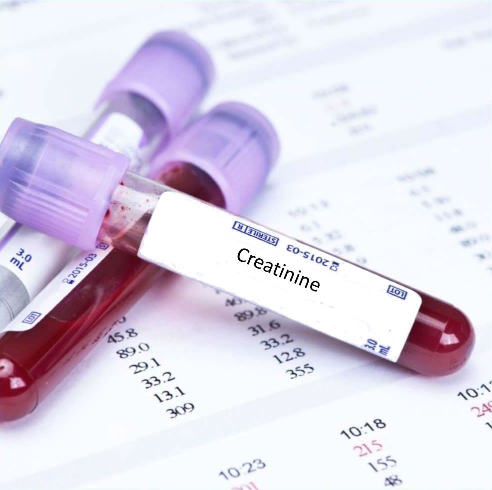 Creatinine Test From RB Diagnostic