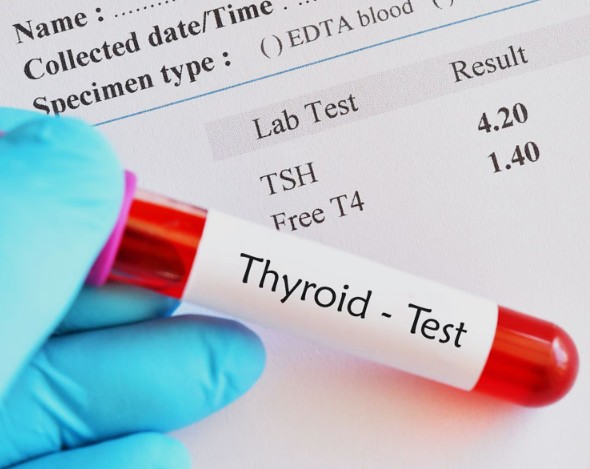 Thyroid Stimulating Hormone (TSH) Test By RB Diagnostic Thyroid Stimulating Hormone (TSH) Test By RB Diagnostic