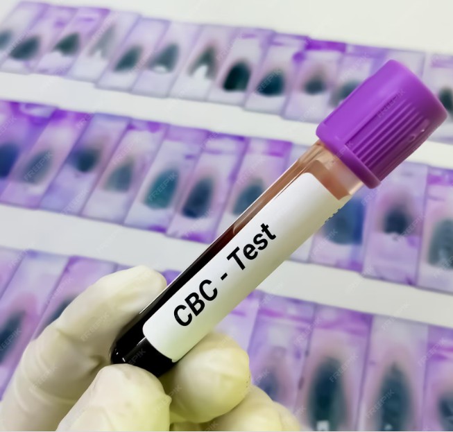 Complete Blood Count (CBC) Test By RB Diagnostic Complete Blood Count (CBC) Test By RB Diagnostic