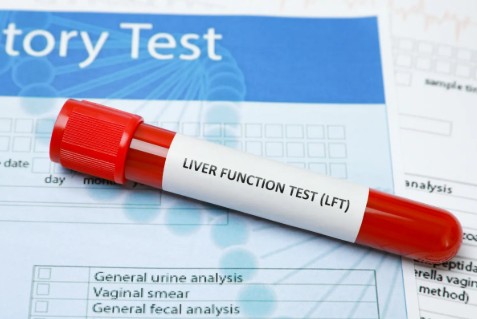 Liver Function Tests (LFTs) By RB Diagnostic